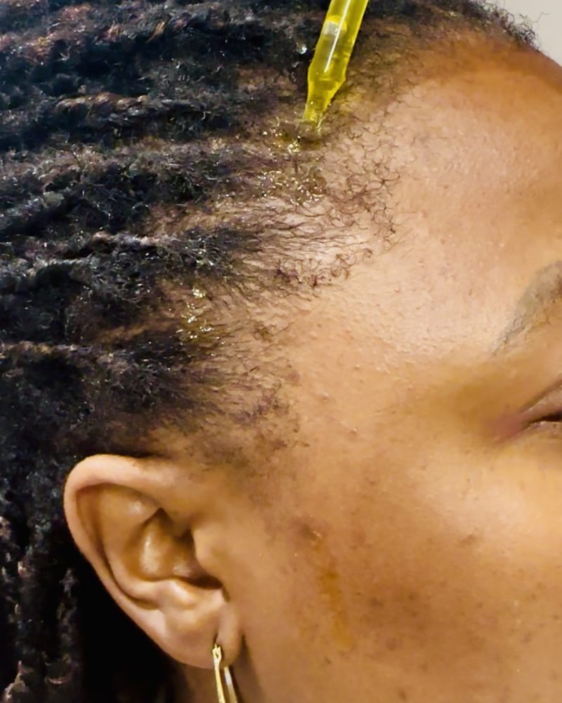 How to use Bambi Hair Growth Oil